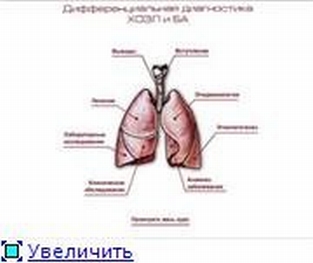 extrasyllogistic
