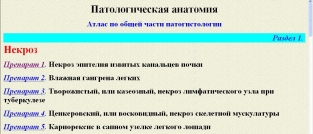 extrasyllogistic