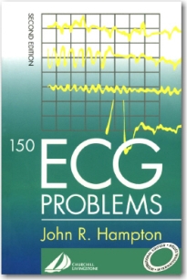extrasyllogistic
