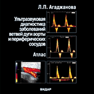 extrasyllogistic