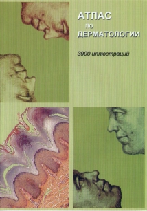 extrasyllogistic
