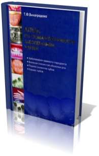 extrasyllogistic