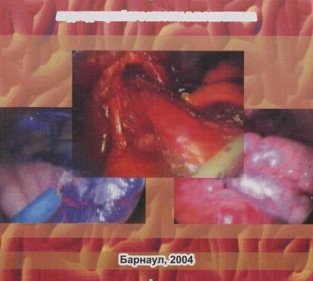 extrasyllogistic