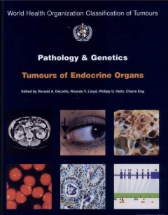 extrasyllogistic